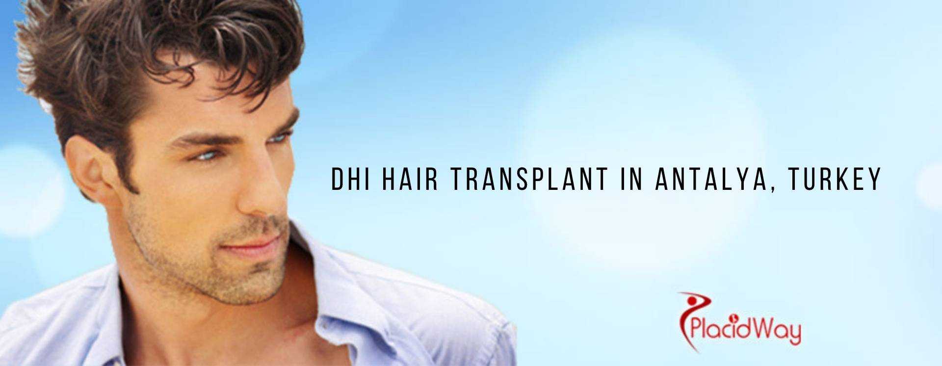 DHI Hair Transplant in Antalya, Turkey